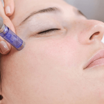 women getting microneedling treatment