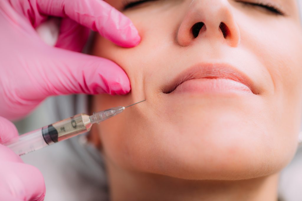  a woman getting dermal filler around the lips