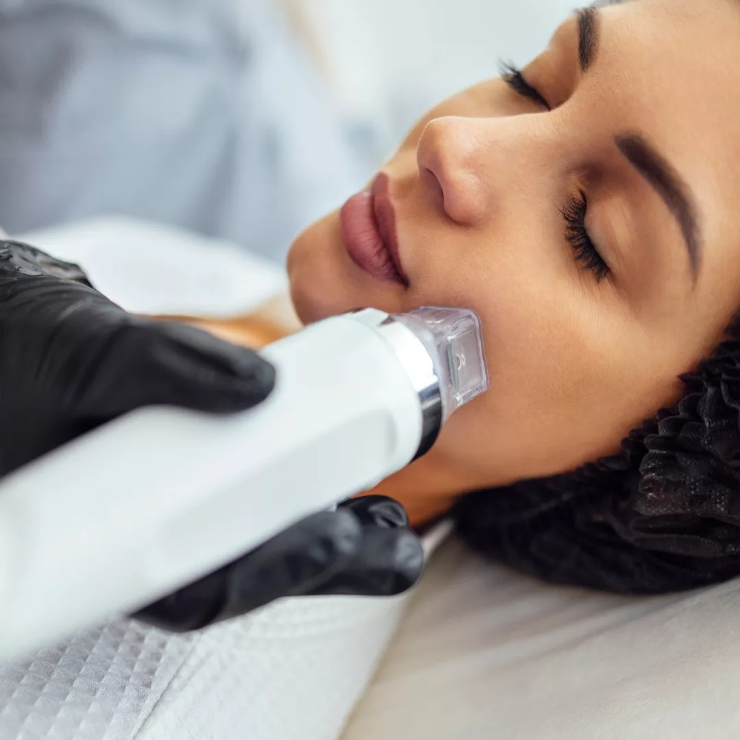a woman getting RF microneedling skin tightening on face