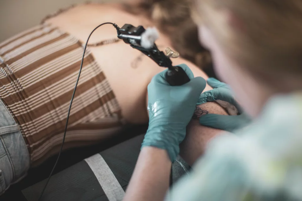  woman getting laser tattoo removal