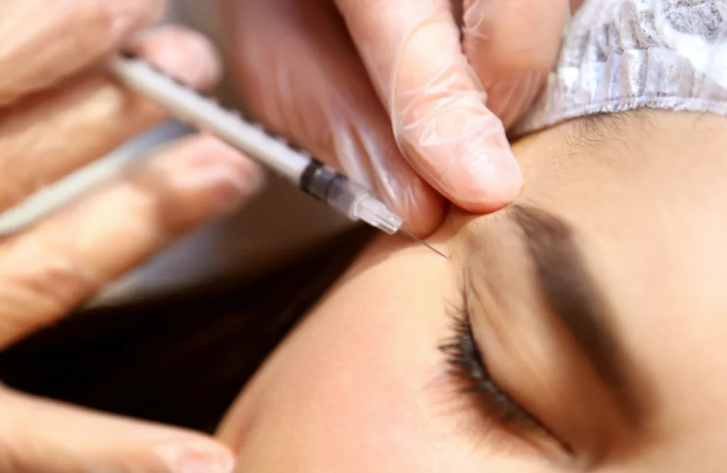  Botox injection around the eye