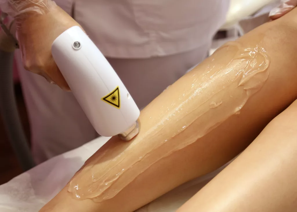 Laser Hair Removal Aftercare The Ultimate Guide to Proper Care