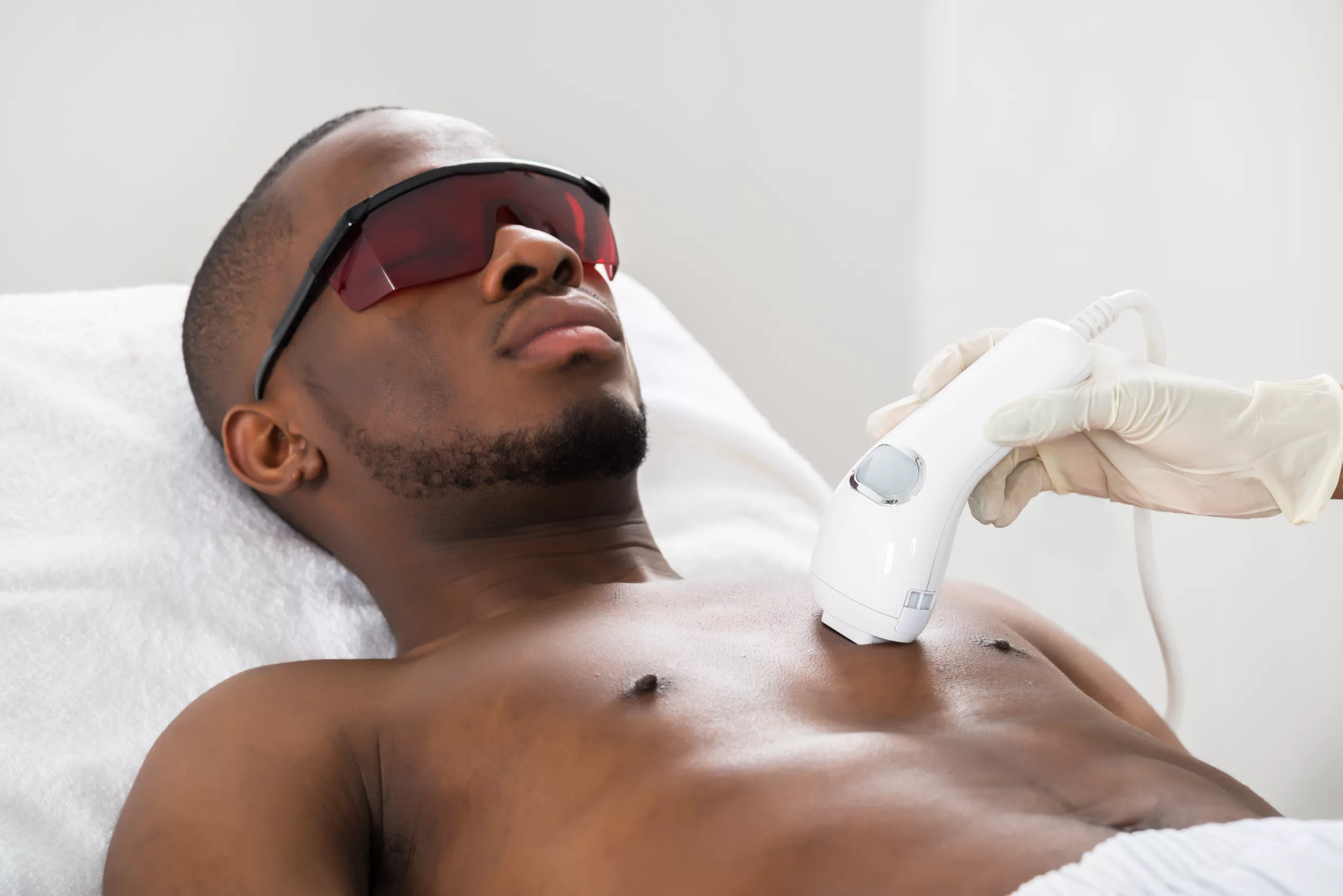 A Guide to Male Laser Hair Removal