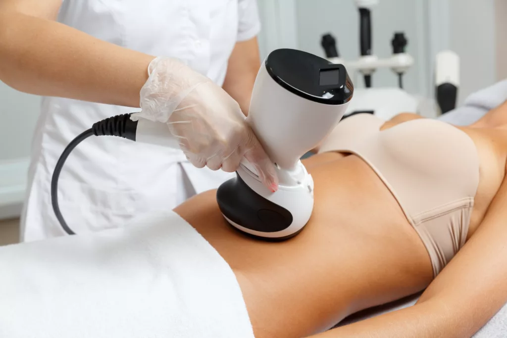 Removing Cellulite With RF Skin Tightening