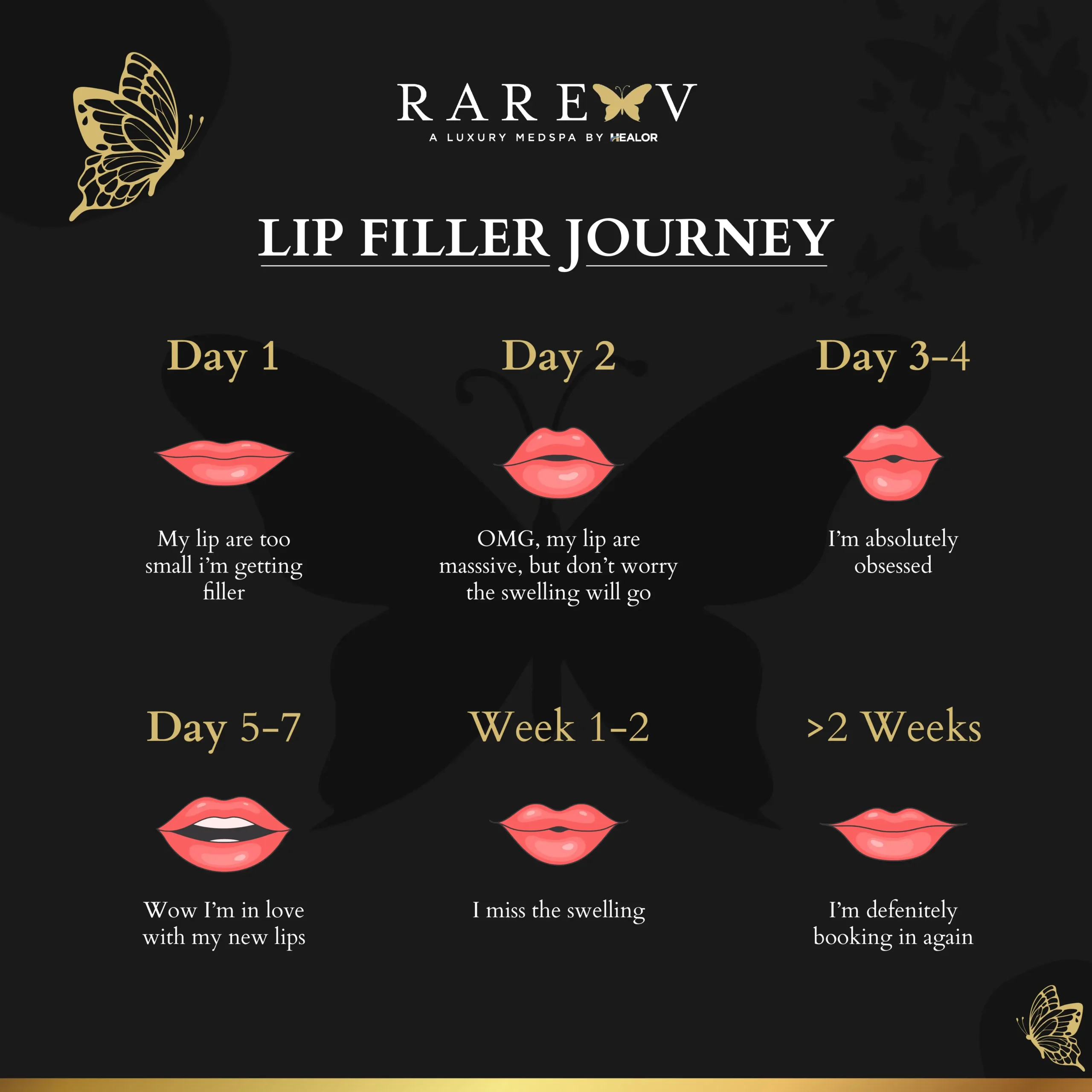 lip filler las vegas journey