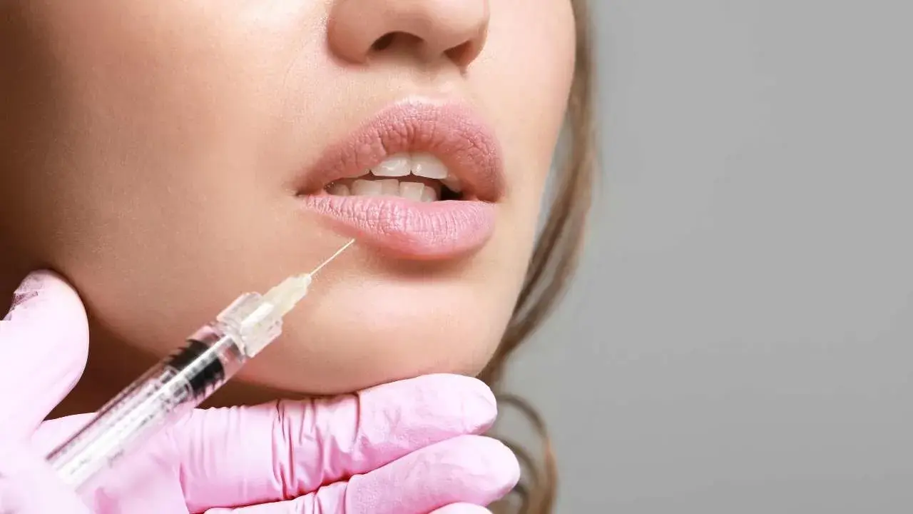 Russian Lip Technique - RAREV Russian Lip Technique vs Classic Lip Fillers