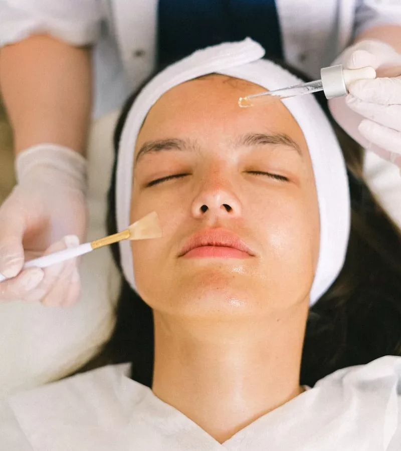chemical peel aftercare